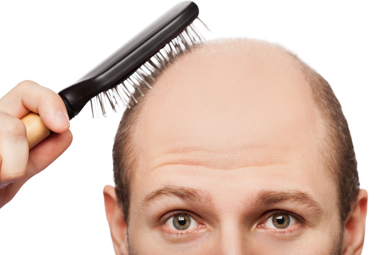 HairLoss-Brushing